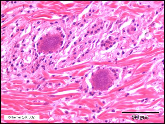 Nocardia Bacteria