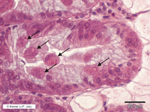 Marteilia refringens by histology