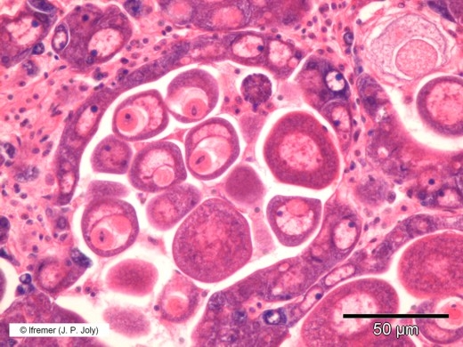 Marteilioides chugmuensis