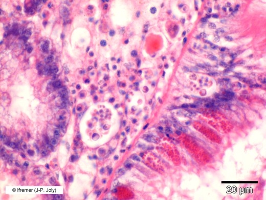 Perkinsus marinus