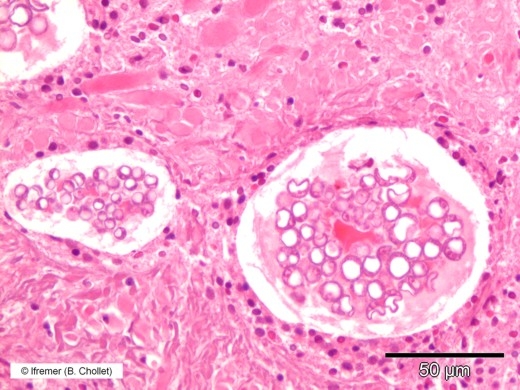 Perkinsus olseni
