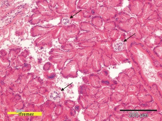 Perkinsus olseni